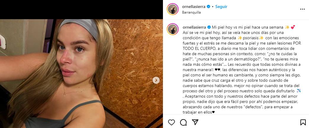 ORNELLA SIERRA